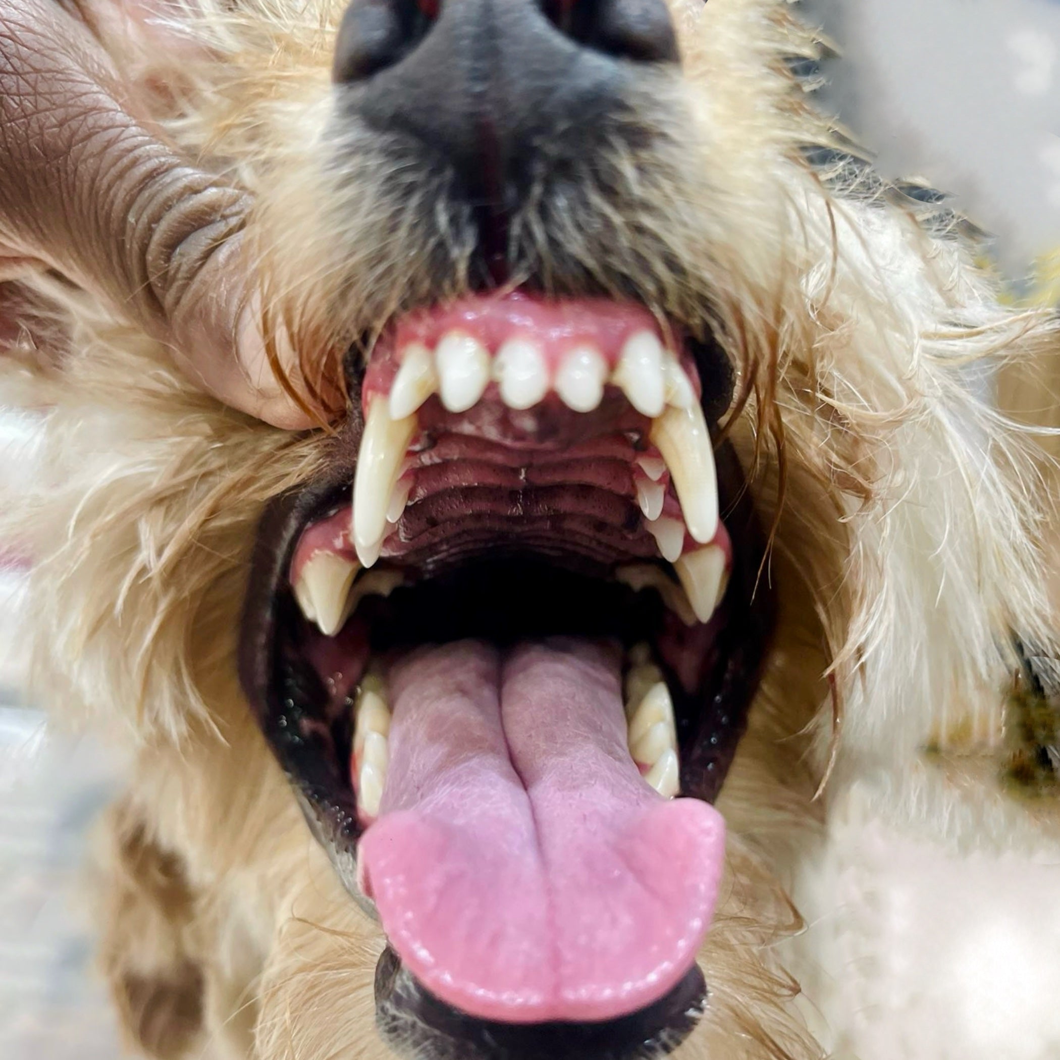 Teeth Descaling Cleaning and Polish