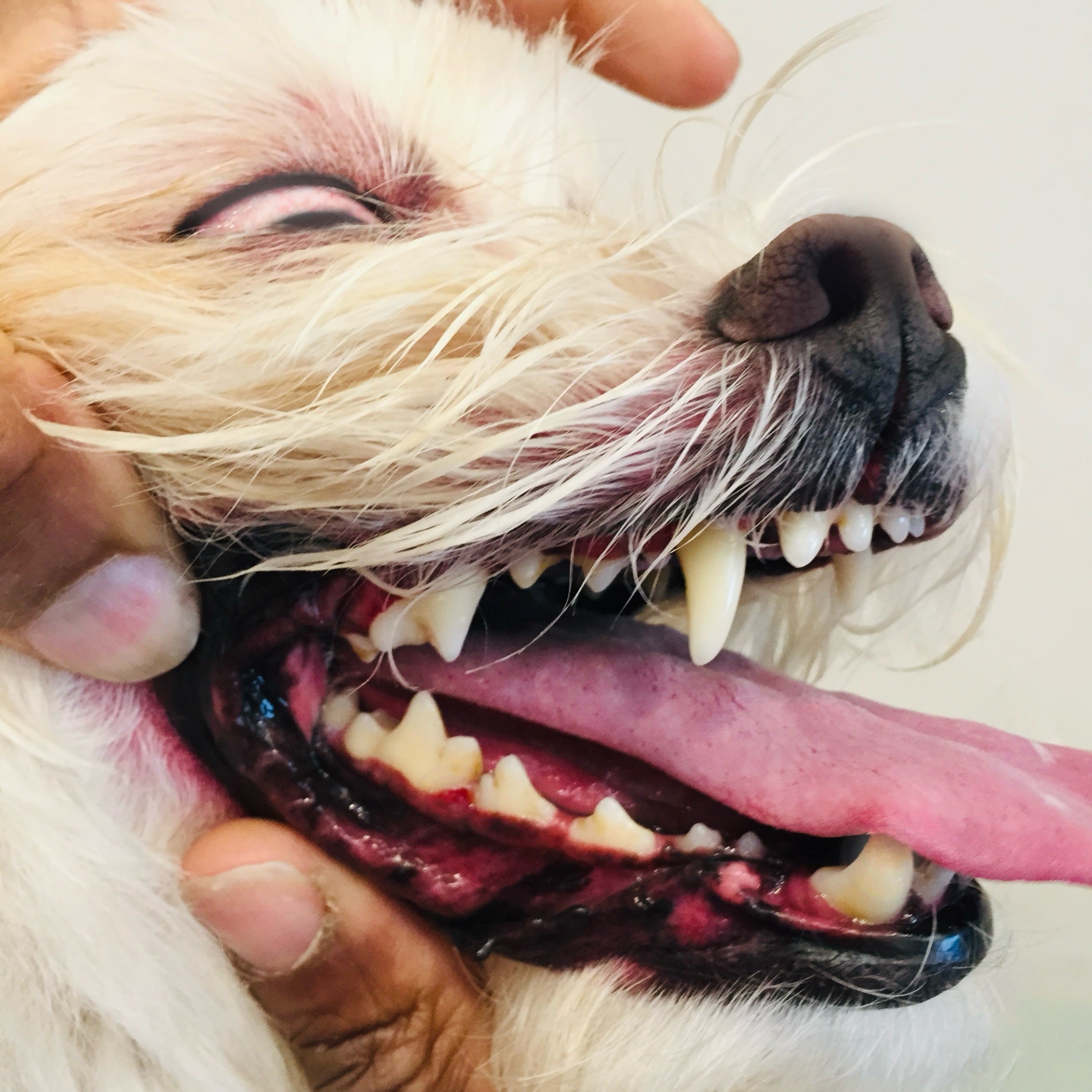 Teeth Descaling Cleaning and Polish